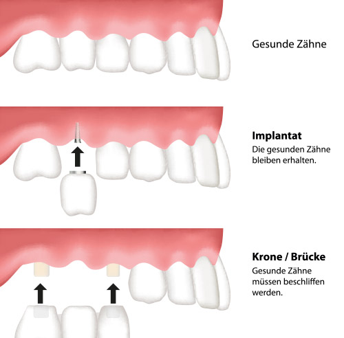 Implantologie Dr. med. dent. Christian Reiter Schrobenhausen