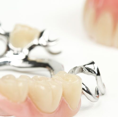 Zahnersatz2 Zahnarztpraxis Dr. Hartmann – Dr.Reiter